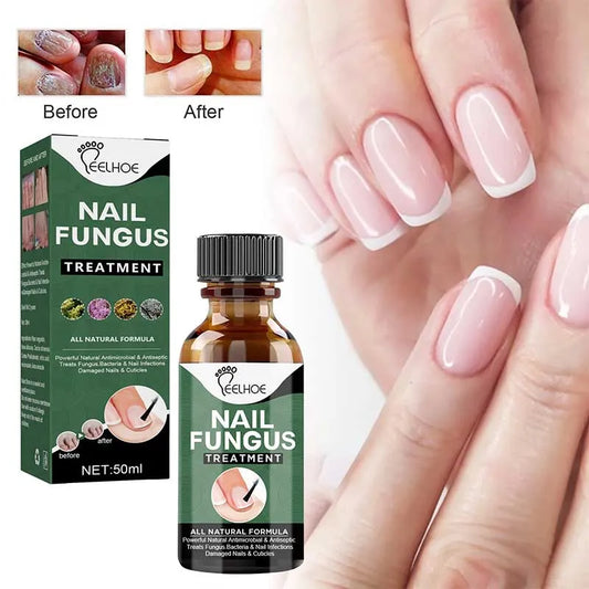 Nail Fungus Treatment Serum 10ml
